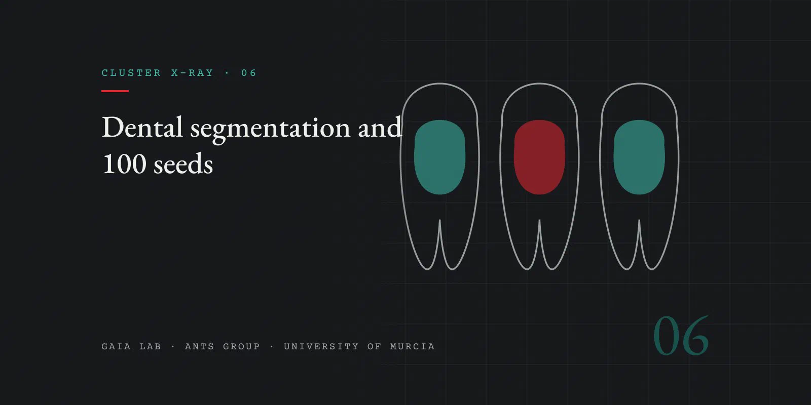 Three tooth silhouettes in grey outline with a coloured inner region, two in teal and one in red, like segmentation masks