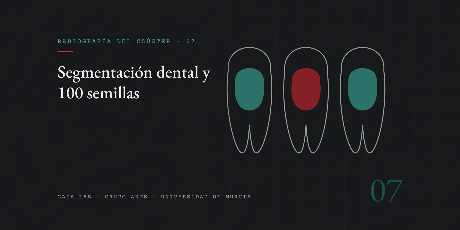 Tres siluetas de dientes en trazo gris con una región interior coloreada, dos en teal y una en rojo, como máscaras de segmentación